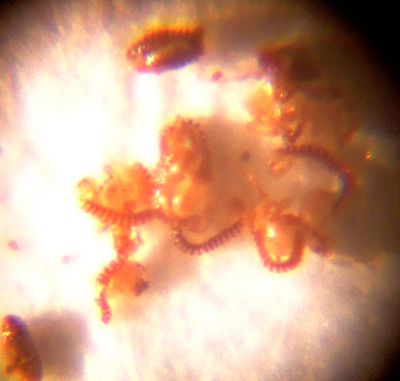 Spores, zoomed in